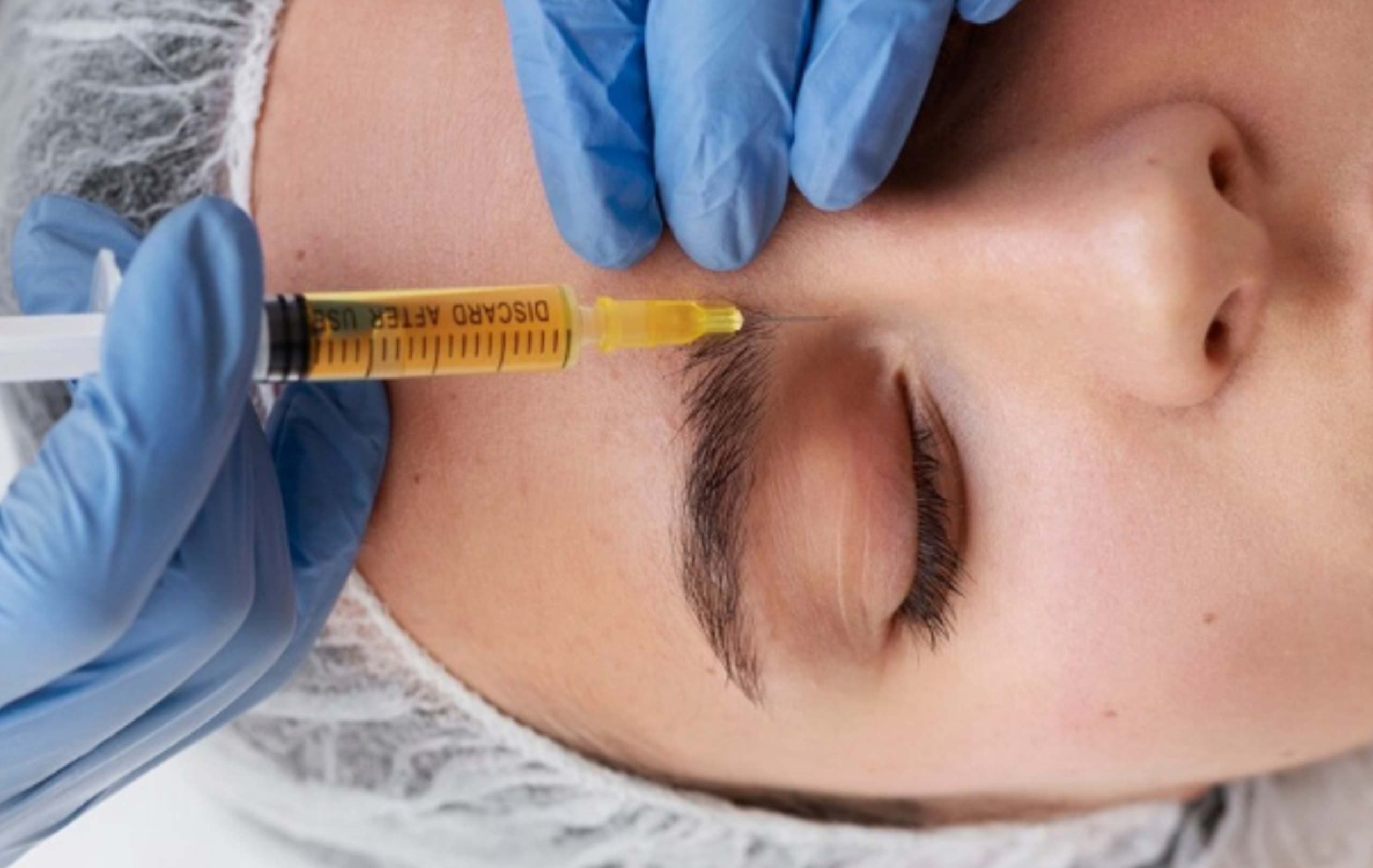 Skin Light + plasma rico en plaquetas (PRP)